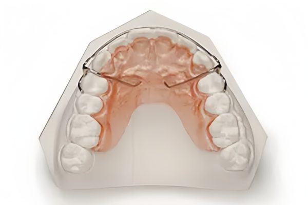 Hawley Retainer with Soldered C Clasps