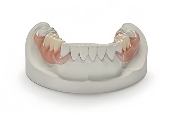 VALPLAST® Flexible Partial